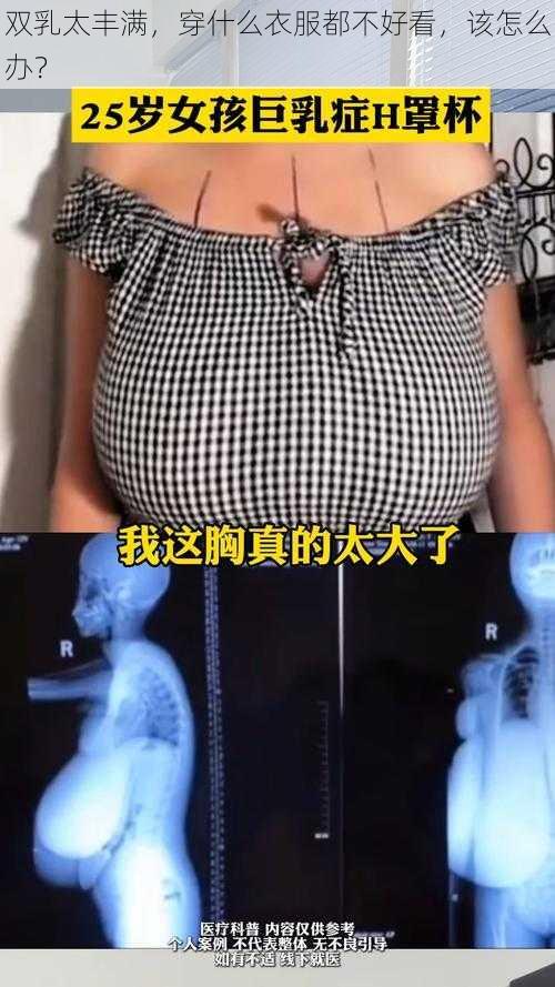 双乳太丰满，穿什么衣服都不好看，该怎么办？