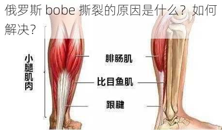 俄罗斯 bobe 撕裂的原因是什么？如何解决？